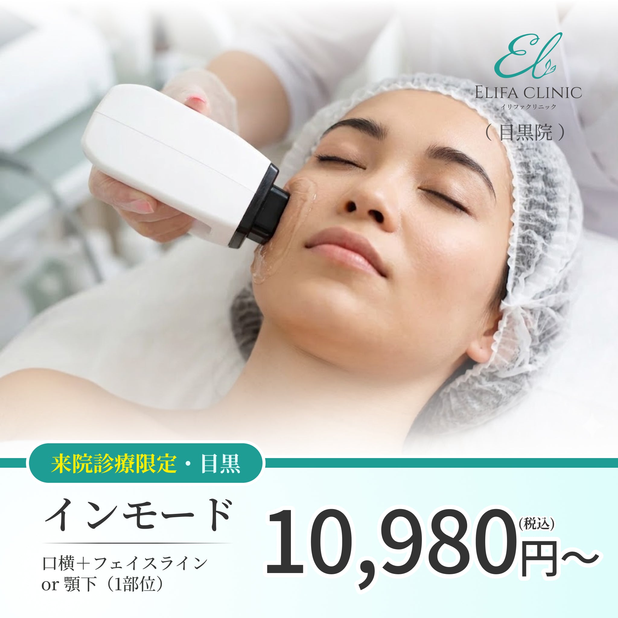 【Elifa Clinic】ePass｜インモード｜口横＋フェイスライン or 顎下｜（1部位）