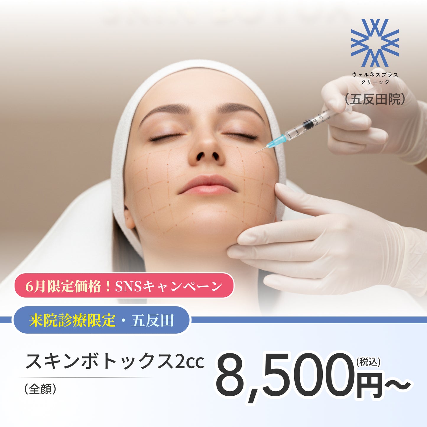 【Wellness Plus Clinic】6月SNSキャンペーン｜スキンボトックス（全顔）