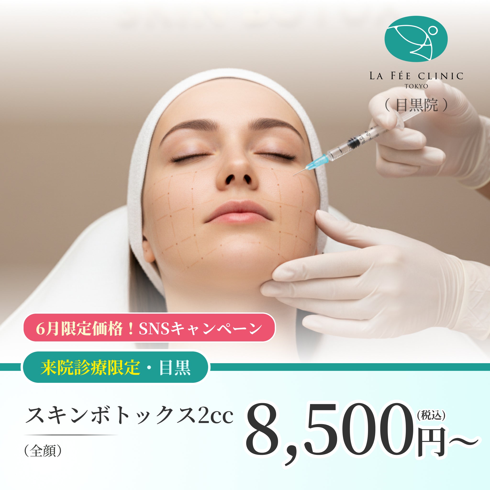 【La Fée Clinic】6月SNSキャンペーン｜スキンボトックス（全顔）