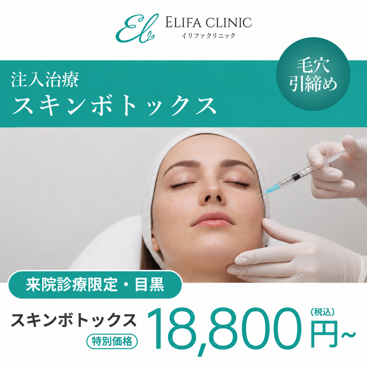 【Elifa Clinic】来院診療｜スキンボトックス2cc